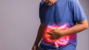 Síntomas del intestino irritable