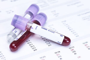 estudio de sangre anticuerpos para detectar alergia al trigo o celiaquia