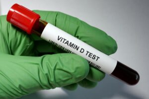 obesidad y vitamina D